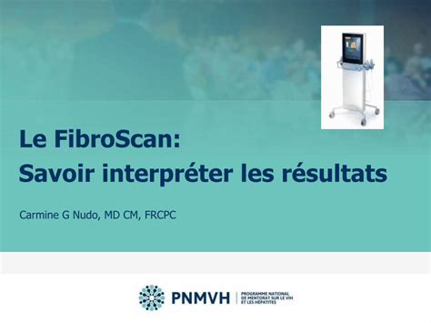 fibroscan interpretation|ou passer un fibroscan.